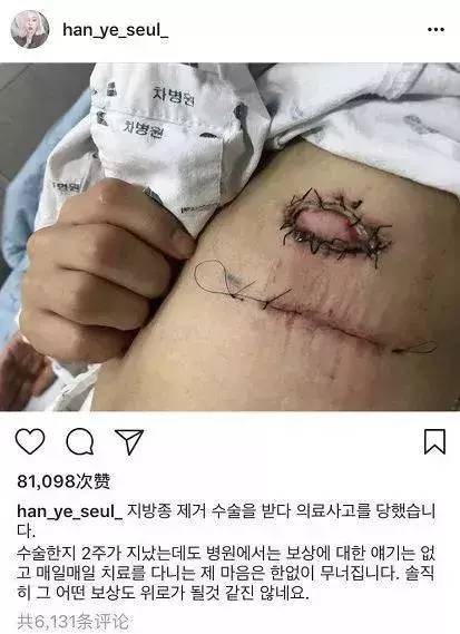 「Dispatch」出道整成“金喜善”，因太美被霸凌，如今40岁像18岁！