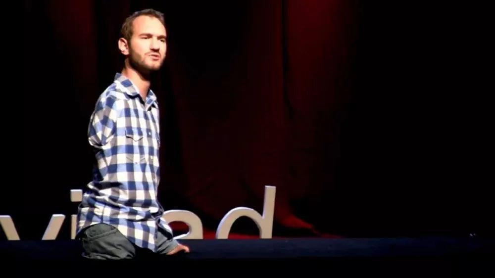 【悉尼印象】他是澳洲最“丑”男孩，连爸妈都嫌弃，长大逆袭亿万富豪轰动全世界....