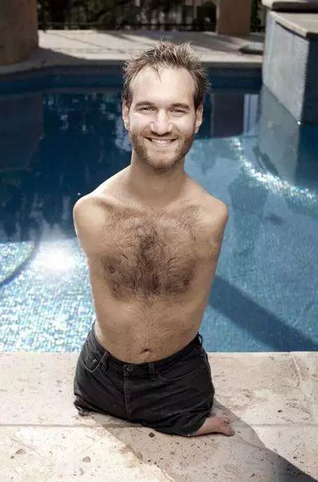 【悉尼印象】他是澳洲最“丑”男孩，连爸妈都嫌弃，长大逆袭亿万富豪轰动全世界....