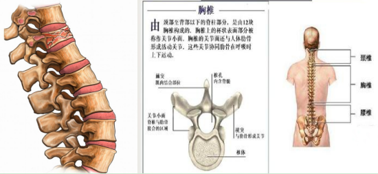 第一醫院西安市第一醫院無痛微創治療多發性骨髓瘤繼發胸椎壓縮性骨折