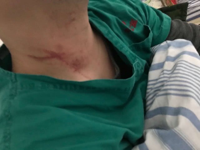 武汉两名抗疫医生被患者家属打伤 警方介入