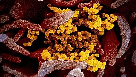 五位科学家发表文章，反驳新冠病毒来源于实验室