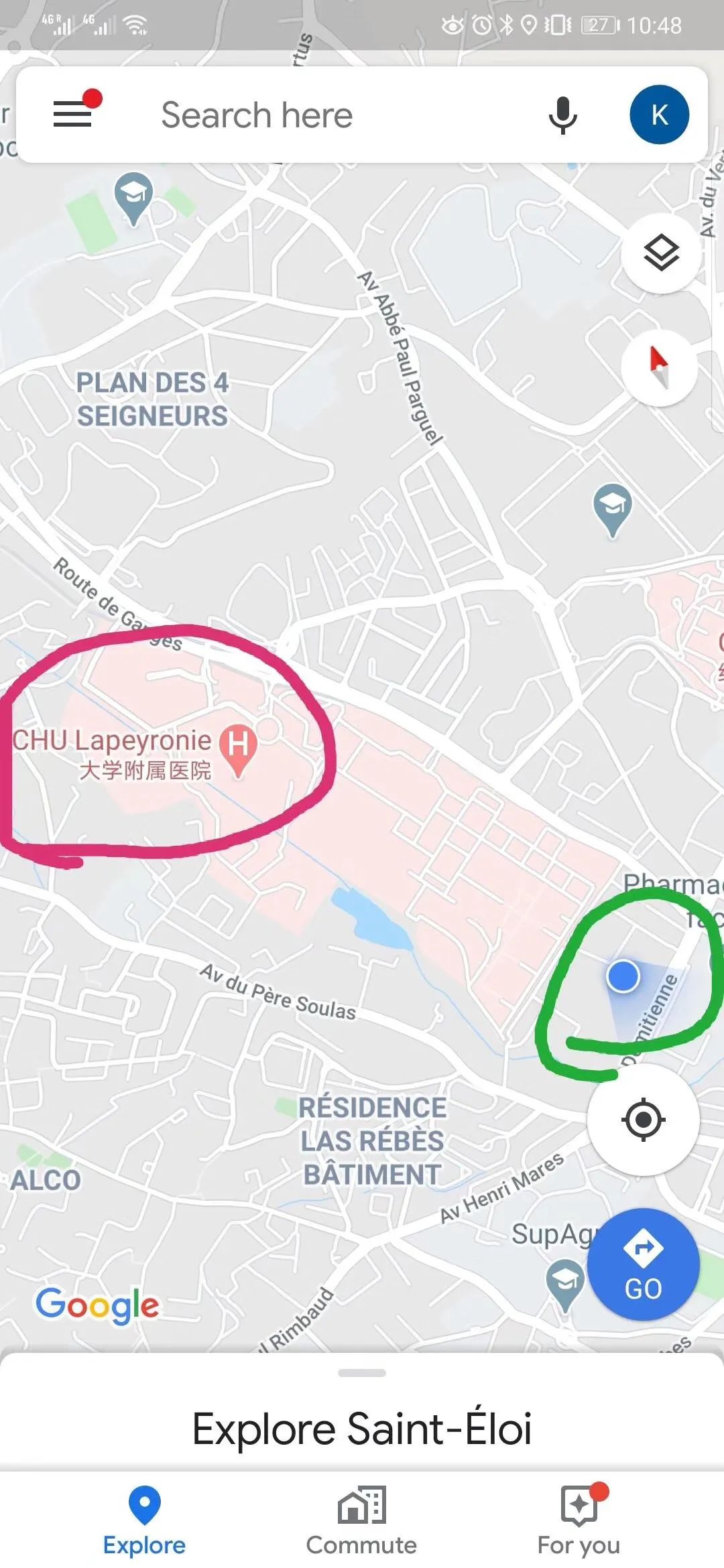 (当地第一例确诊患者入住的医院距离黄坤住所非常近)