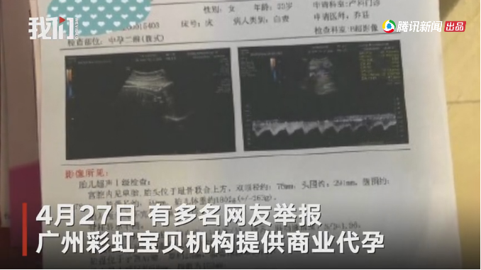 广州机构疑为男同性恋群体代孕被举报 卫健部门已介入
