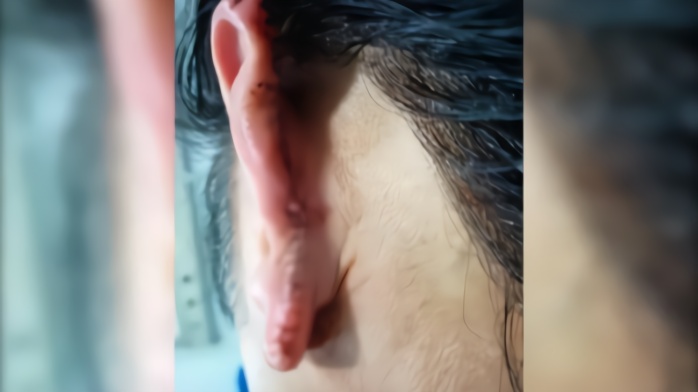 在上海巨鹿路咬耳伤人的男子,已在新疆被抓获(视频)