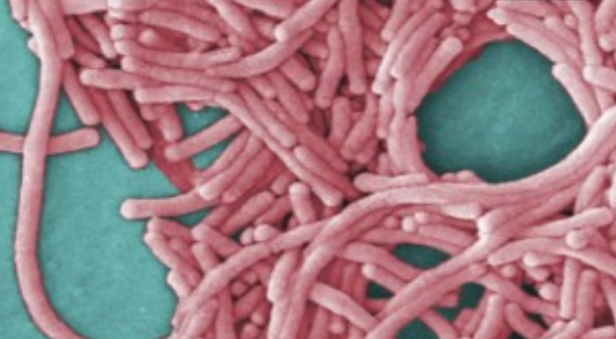 彩色电子显微镜扫描显示的军团菌  图片来源：CNN