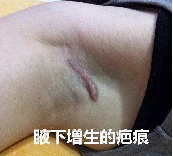 【上海韩啸】医生技术经验如何影响隆胸手术并发症发生率及手术效果?