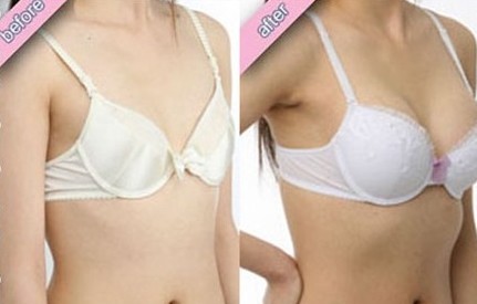 【上海韩啸】医生技术经验如何影响隆胸手术并发症发生率及手术效果?