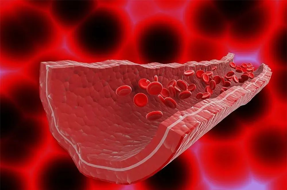 寿命长短原来跟血管健康有关延缓衰老的四大法宝在这