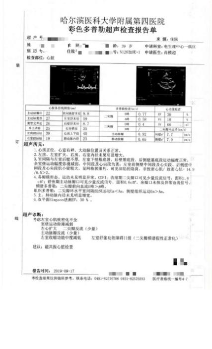 哈醫大四院心內電生理一病區植入crtd成功治療難治性心力衰竭