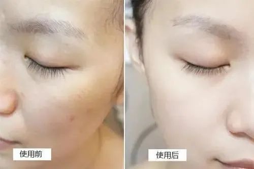 皮肤修复时间多少天 F7E71306ECF995DEC784276D0A33064CF8A7B861_w500_h334.jpg