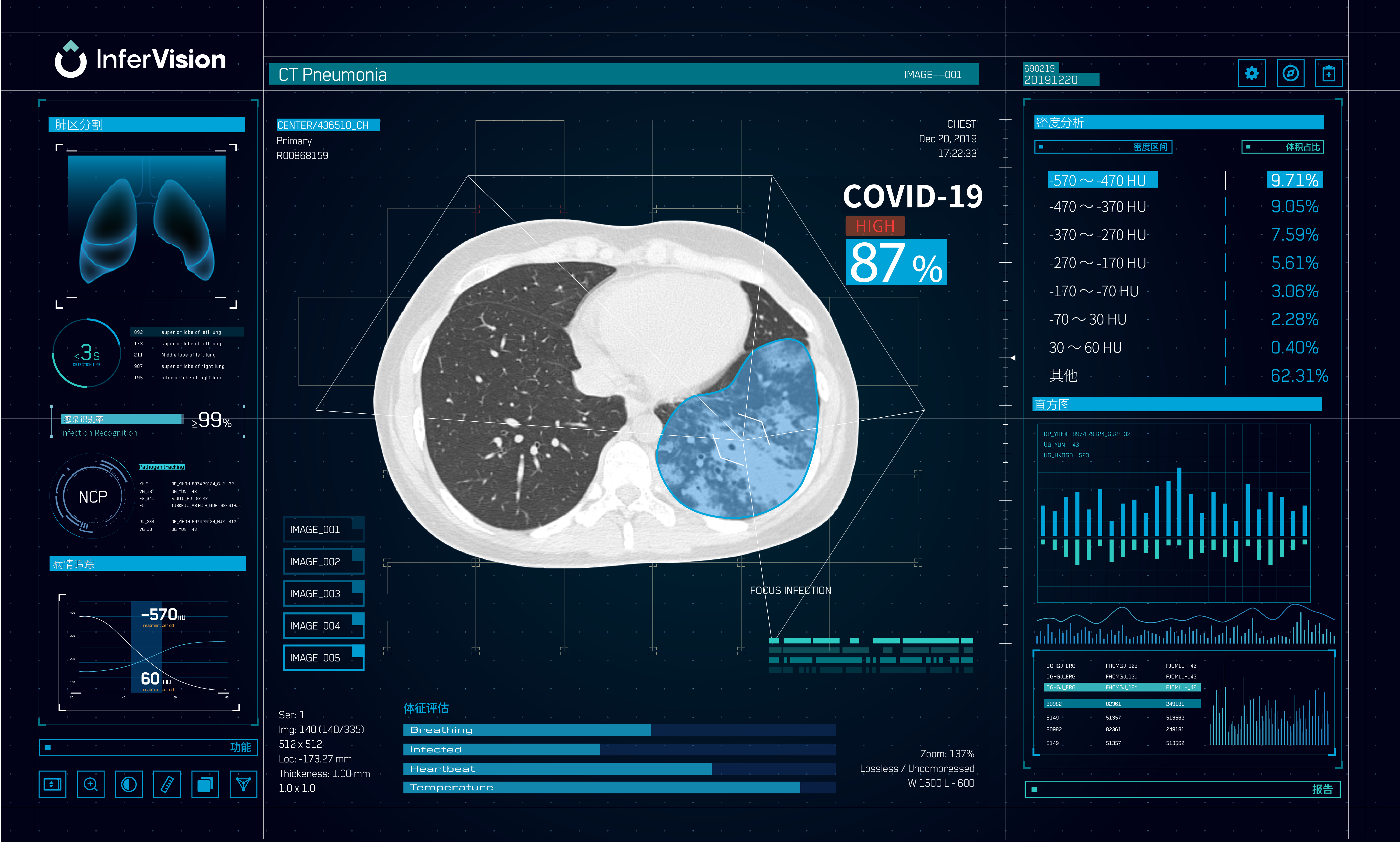 智能医生的缔造者 新冠肺炎ai影像辅助诊断系统