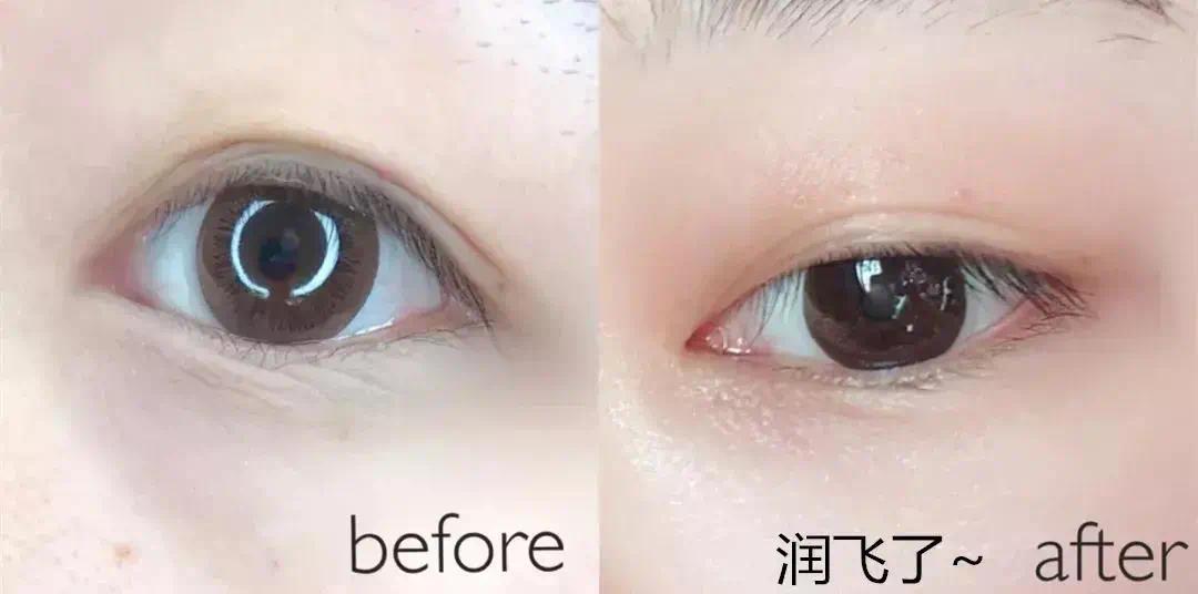 如何快速放松眼球 7109CE583D077AAFB66E5520C5F3C249A08D36FF_w1080_h536.jpg