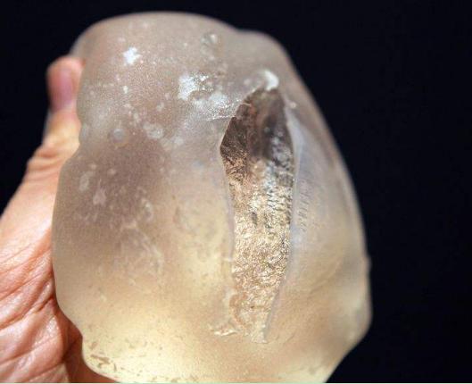 假体隆胸术后手感到底能维持多久?