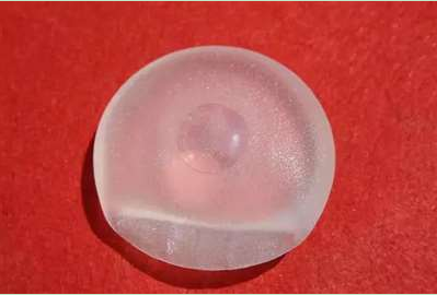 假体隆胸品牌‖隆胸后胸部硬如石头 选择隆胸还靠谱吗?