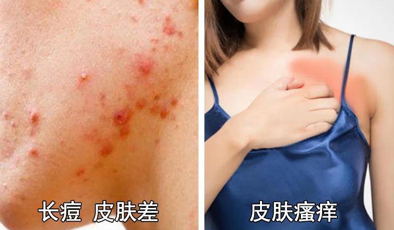 毛巾界的"雅诗兰黛",透气速干,不发霉不发臭,守护家人皮肤健康!