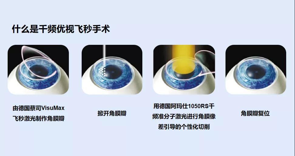北京近视手术医院：重塑明亮双眸的新选择