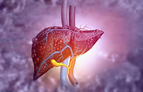 水飞蓟作用4个护肝法助力肝健康远离酒精肝