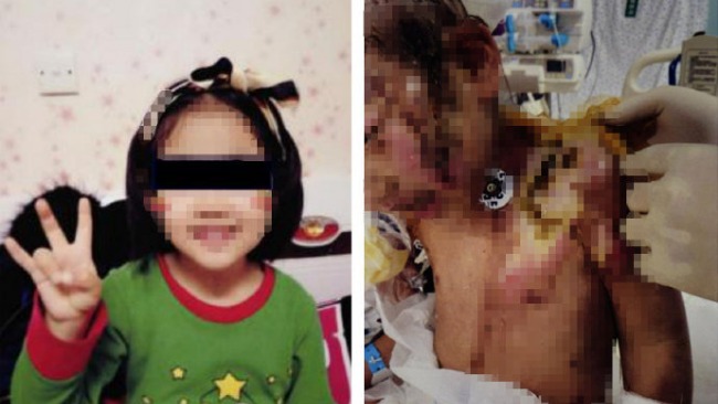 6岁女童遭亲妈及男友虐待险丧命 生父：光骨折几十处_凤凰网 
