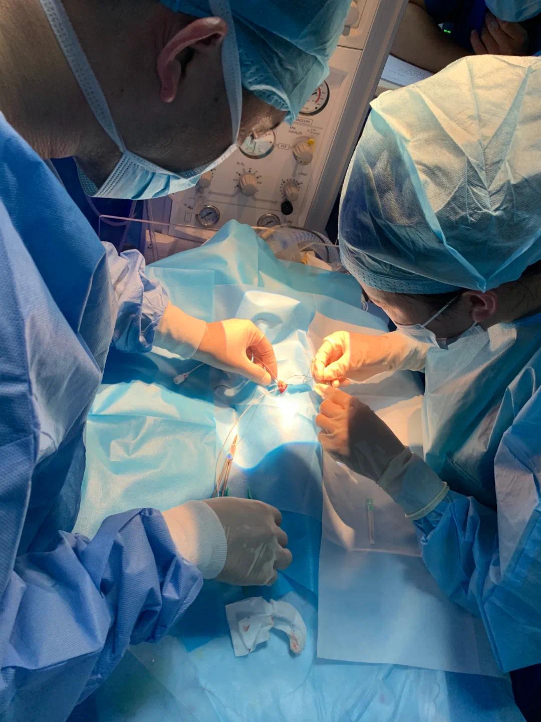 脐动静脉置管为宝宝架起新的生命桥梁