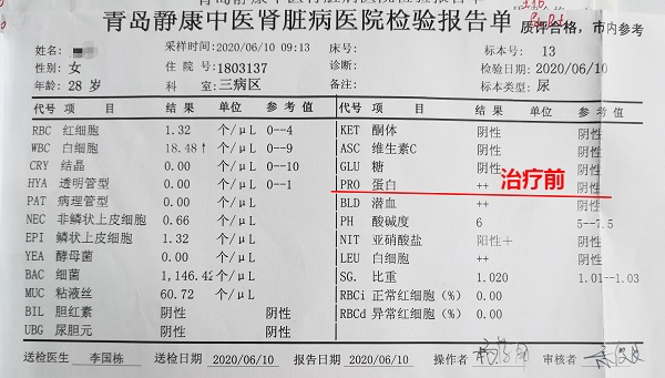 肾炎检查单图片