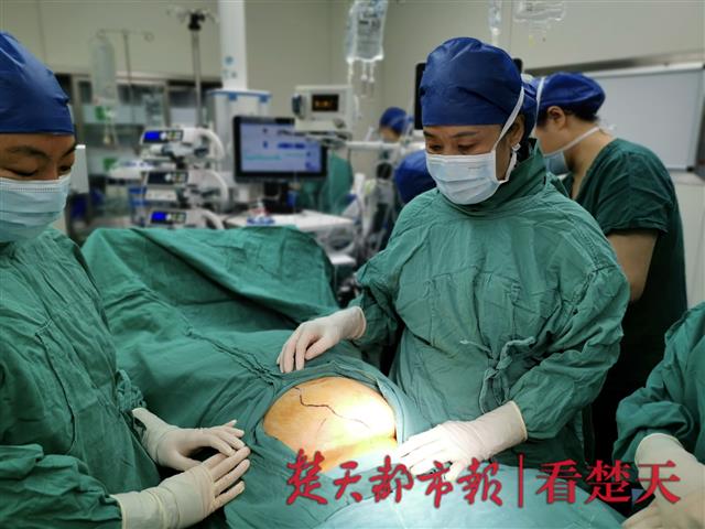 怀孕26周,可胎儿竟然不在子宫里,而是另辟一地,"安家"在母亲腹内的