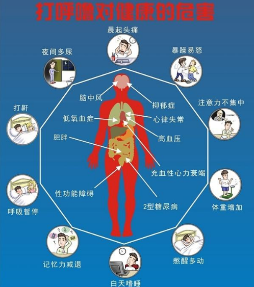 打鼾克星闪耀进博会asonor安速宁带来安稳睡眠