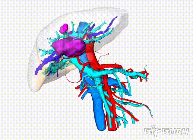 术前肝脏三维重建模型