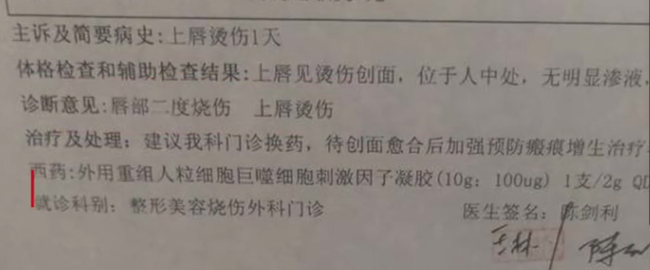 医院诊断患儿唇部二度烧伤。