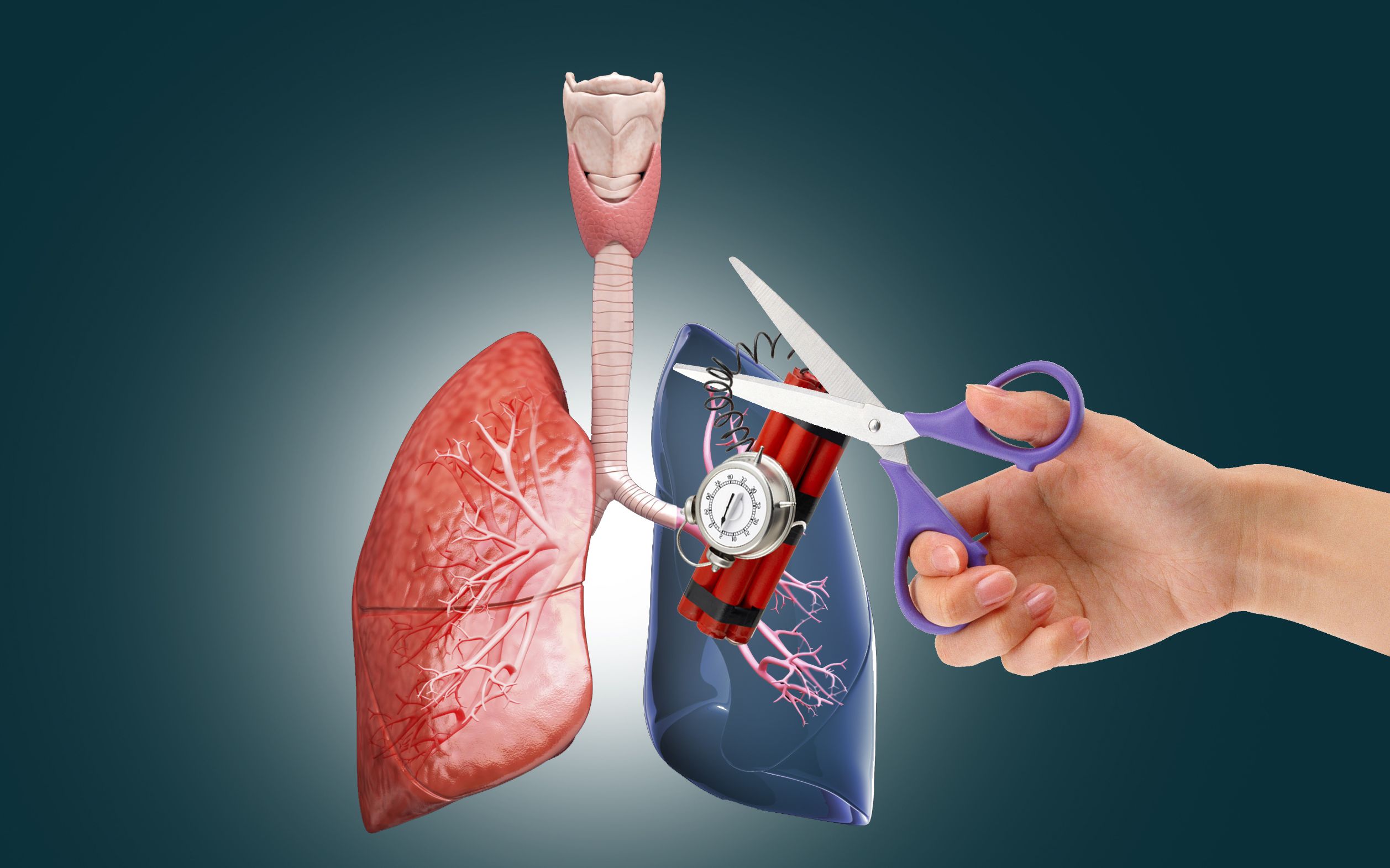 年轻人也会突发肺栓塞专家与年龄关系不大