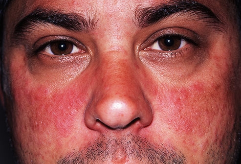 赴美就医时如何通过面部变化获知自己的健康状况