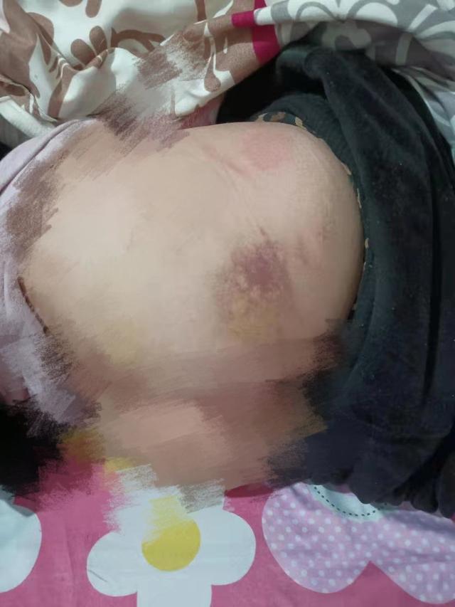 山西初三女生遭校长殴打被逼写“性行为检讨书”，家人称校长曾想赔偿二三万元私了，当事校长已停职