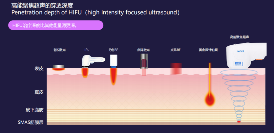 层等,并且形成一个微细热凝固点tcp(focalthermal coagulationpoints)
