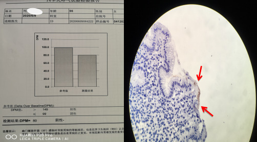 幽门螺杆菌检查报告图片