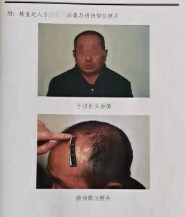 儿被打成重伤老母反映问题失踪，嫌疑人取保潜逃20年，期间多次回家，办了二代身份证和低保