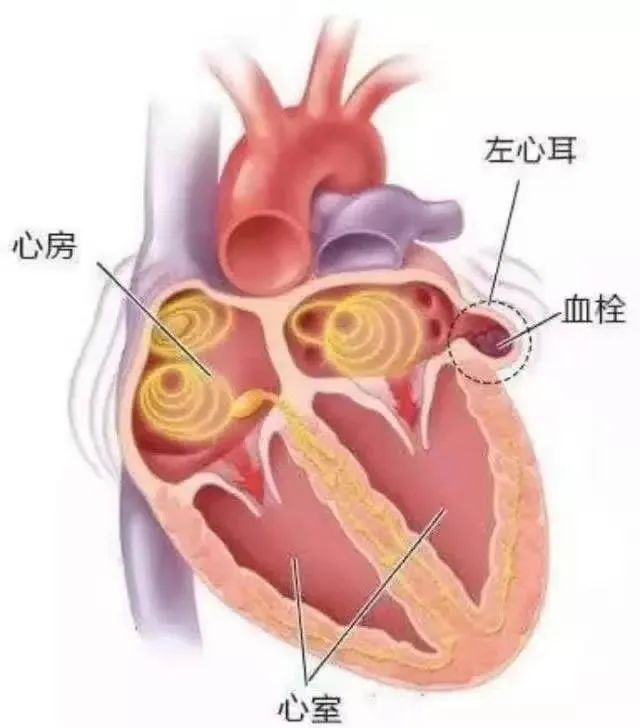 左心耳解剖图