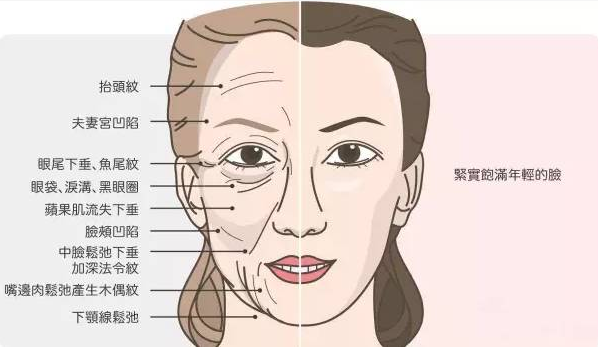 宋超超不是所有的胶原蛋白增生对抗衰起到正向的作用