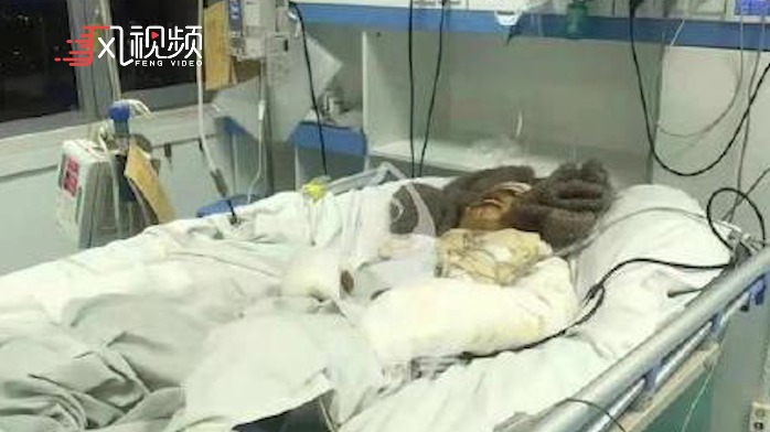 饿了么就骑手因被欠薪5000元自焚事件回应:痛心不已,治疗费用由平台