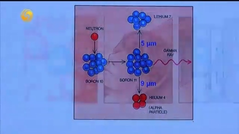 刘志博：核医学精准诊疗一体化，癌症诊疗有了新方案