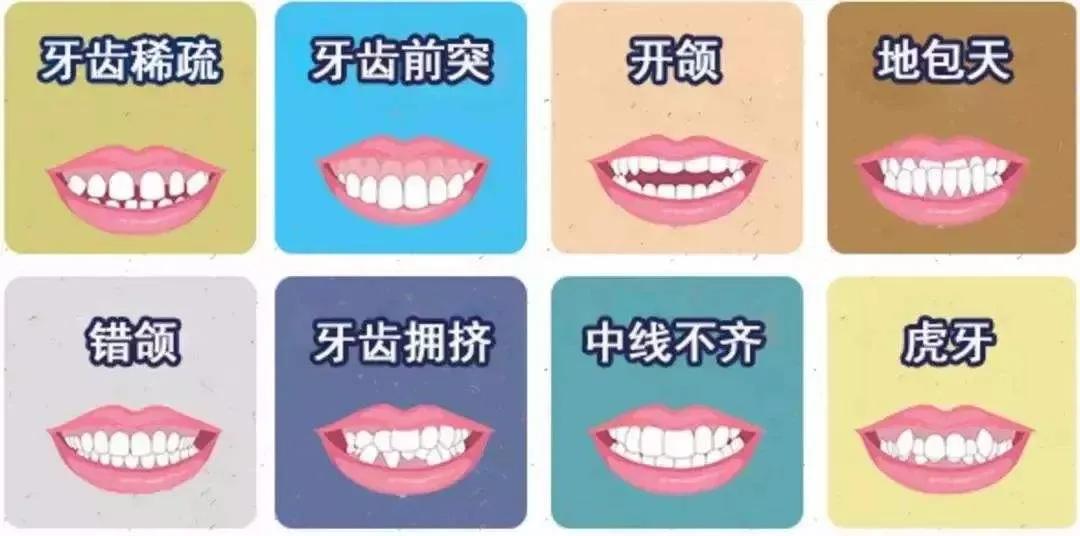 整牙人！正畸前必须思考这些问题