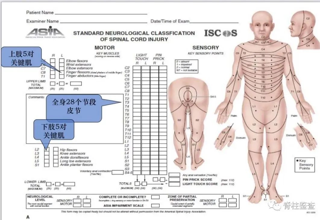 图： 脊髓损伤神经学分类国际标准