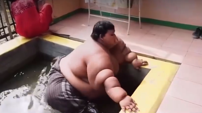 15岁男孩5年减重超200斤，前后对比惊人！