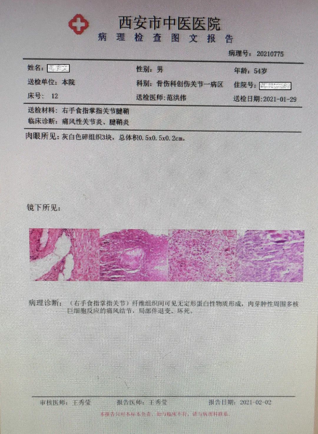 尿酸检测报告单图片图片