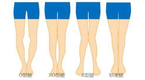 北京禾美嘉任学会教您自测腿型