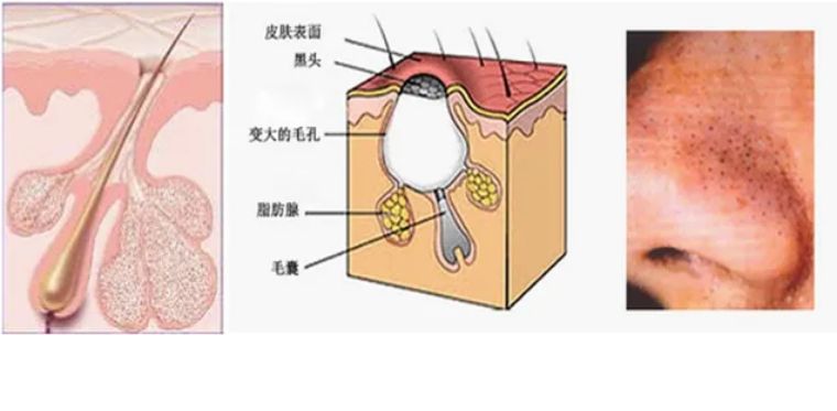 章子怡被骂完，刘涛还敢上？