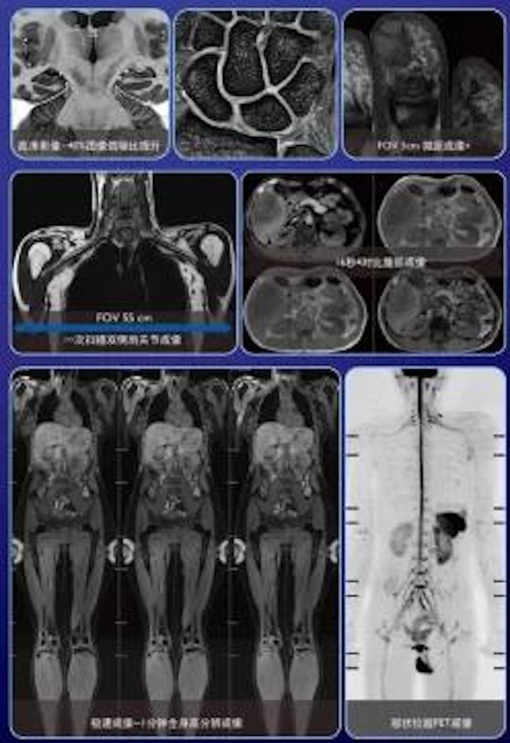 飞利浦全数字磁共振成像系统Ingenia3.0T MRI  落户西海岸新区中心医院