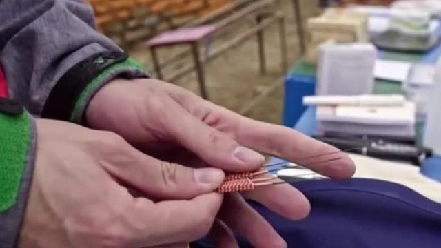 中医师们来到尼泊尔小山村进行义诊，当地村民根本不懂针灸是什么意思