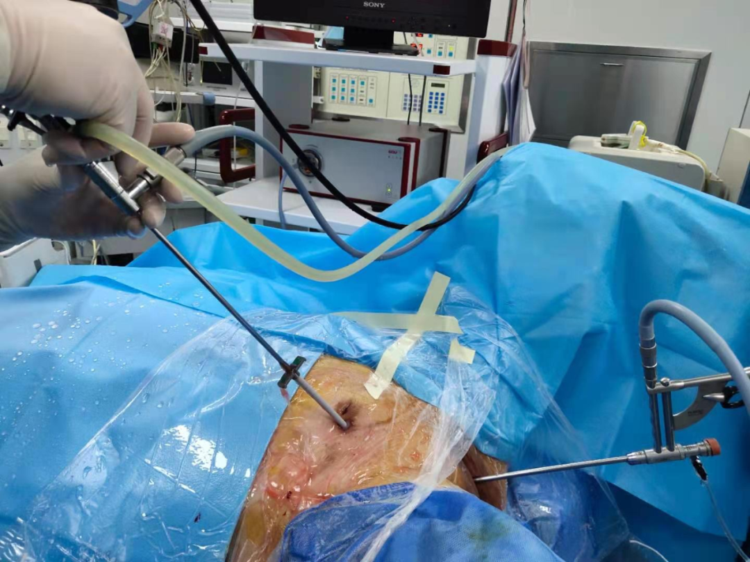 西安市第一医院听到病人手术成功的消息护士长哭了