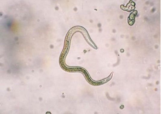 猫身上的寄生虫有哪些怀孕可以养猫吗