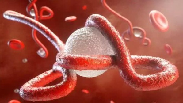 埃博拉与拉沙热都属于出血性病毒，这种病毒是如何将人置于死地的？